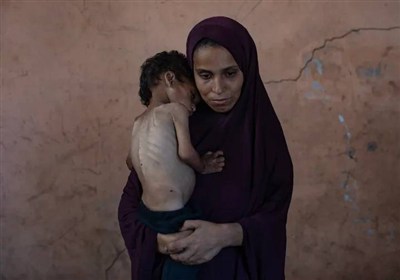 واکنش هنرمندان ایرانی به گرسنگی کودکان در غزه